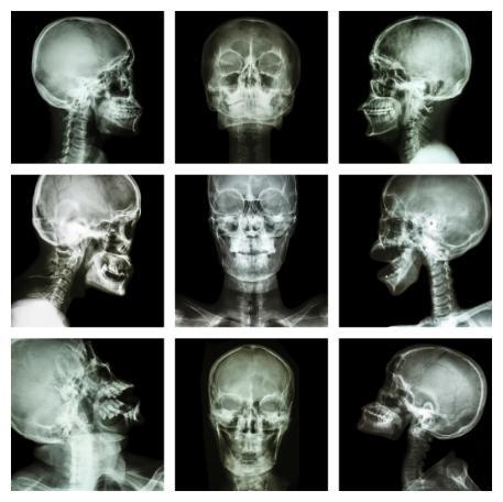 3d scan of 9 angles of the skull